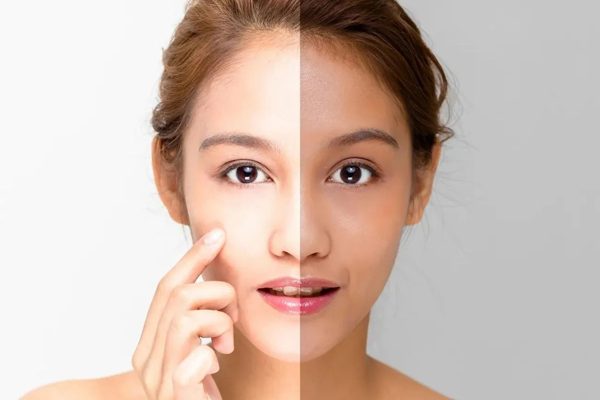 بهترین کرم روشن کننده پوست